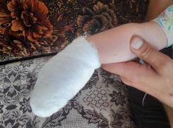Ещё одному ребёнку в Самарской области оторвало палец на карусели