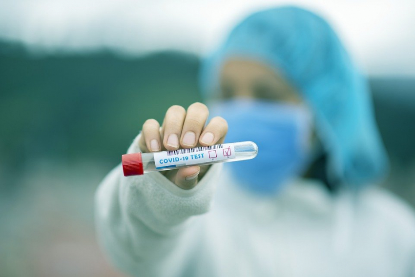 В Самарской области за сутки выявлено 73 новых случая коронавируса