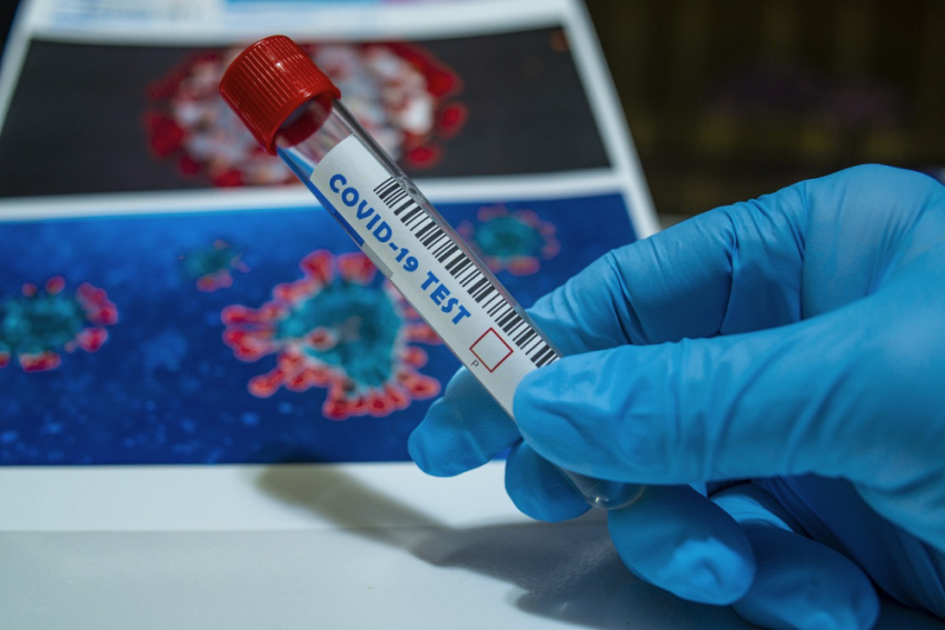 В Самарской области за сутки зарегистрирован 61 новый случай коронавируса