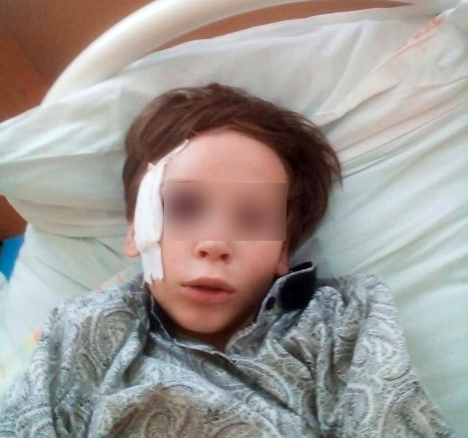 Спасали в две руки: в Самарской области малыш разбился на качелях